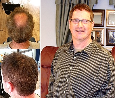Sheldon Craig before and after ld sheldon